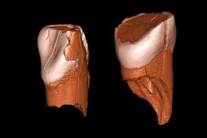 Dreidimensionale digitale Modelle des unteren Schneidezahns aus Riparo Bombrini (links) und des oberen Schneidezahns aus der Grotta di Fumane (rechts). Foto: Daniele Panetta