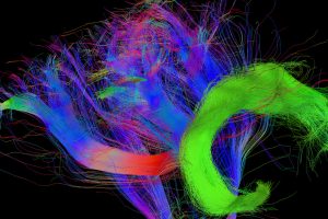 Faserverbindungen im Gehirn eines vierjährigen Kindes, bei dem der Fasciculus Arcuatus (grün) bereits stärker ausgebildet ist – der entscheidende Entwicklungsschritt um uns in andere hineinversetzen zu können. Foto: MPI CBS