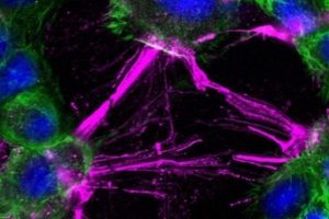Mikroskopisches Bild von Zellen, die mechanischen Scherkräften ausgesetzt wurden. Die Zellen (blau: Zellkern, grün: Aktin-Zellskelett) verändern ihre Form, ziehen sich zusammen und lösen ihre Kontakte. Der Rezeptor CD97 wird in Fasern der kontrahierenden Zellen phosphoryliert (magenta). Foto: Prof. Dr. Gabriela Aust