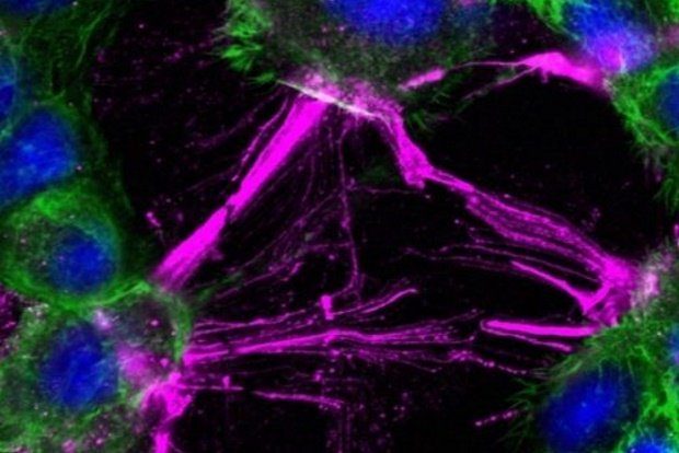 Mikroskopisches Bild von Zellen, die mechanischen Scherkräften ausgesetzt wurden. Die Zellen (blau: Zellkern, grün: Aktin-Zellskelett) verändern ihre Form, ziehen sich zusammen und lösen ihre Kontakte. Der Rezeptor CD97 wird in Fasern der kontrahierenden Zellen phosphoryliert (magenta). Foto: Prof. Dr. Gabriela Aust