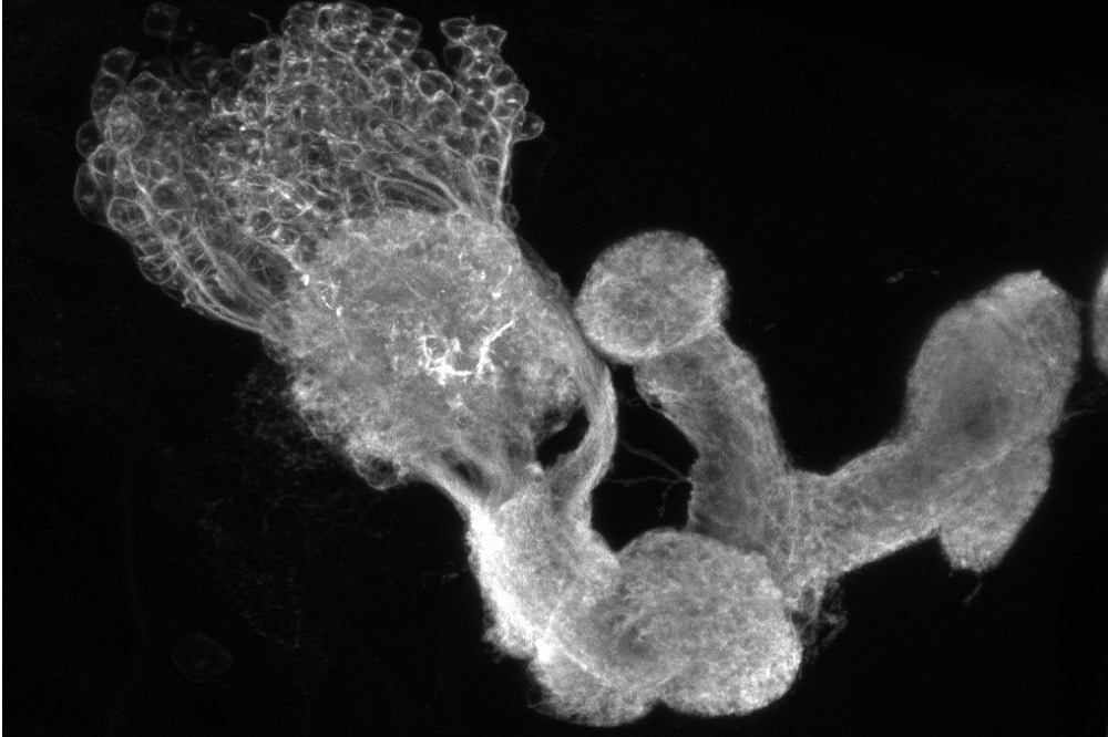 Bild eines Pilzkörpers: In diesem Teil des Gehirns der Fruchtfliegenlarve werden Gedächtnisse gespeichert. Foto: Dr. Mareike Selcho/Universität Würzburg