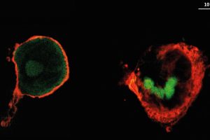 Aufnahmen von Makrophagen (rot), in denen der Wirkstoff (grün) verteilt ist. Links ist der Wirkstoff Heparin zu sehen, rechts Hyaluronsäure. Foto: Hala Al Khoury