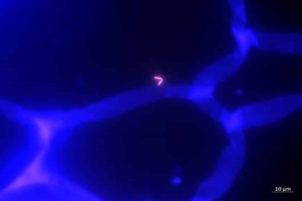 Lebendige Bakterien leuchten im Fettgewebe © Universität Leipzig, Prof. Peter Kovacs