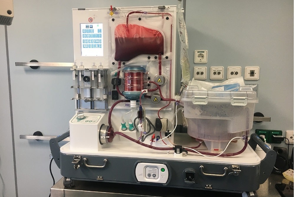 In diesem vollautomatisierten Organperfusionsgerät kann das Innere des menschlichen Körpers fast perfekt nachgebildet werden. Operateure haben so mehr Zeit für eine Transplantation. Neben dem Leipziger Uniklinikum besitzen derzeit bundesweit nur zwei weitere Zentren eine solche Maschine. Foto: UKL