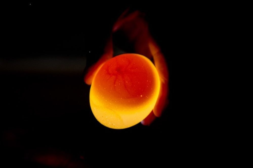 Bildquelle: Hochschulmedizin Dresden