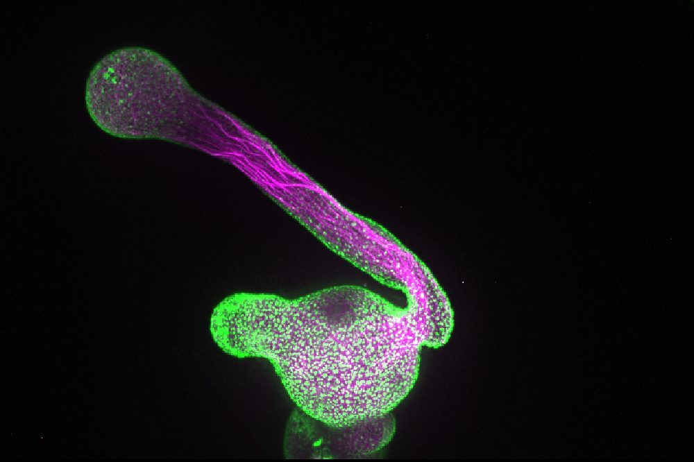 Ein Pollenschlauch, der aus einem Pollenkorn wächst (Grün: Enzym, das für die Produktion des Lipids verantwortlich ist, welches das Zellwachstum beeinflusst, Magenta: Zytoskelett). Foto: Marta Fratini