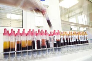 Bis 10. Juli können Blutspender bei der UKL-Blutbank im Rahmen ihrer Spende eine Corona-Antikörpertestung durchführen lassen. Foto: Stefan Straube / UKL