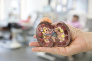 Modell einer Niere auf eine Hand liegend