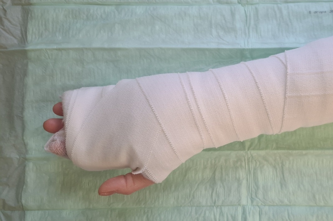 Eine verbundene Hand