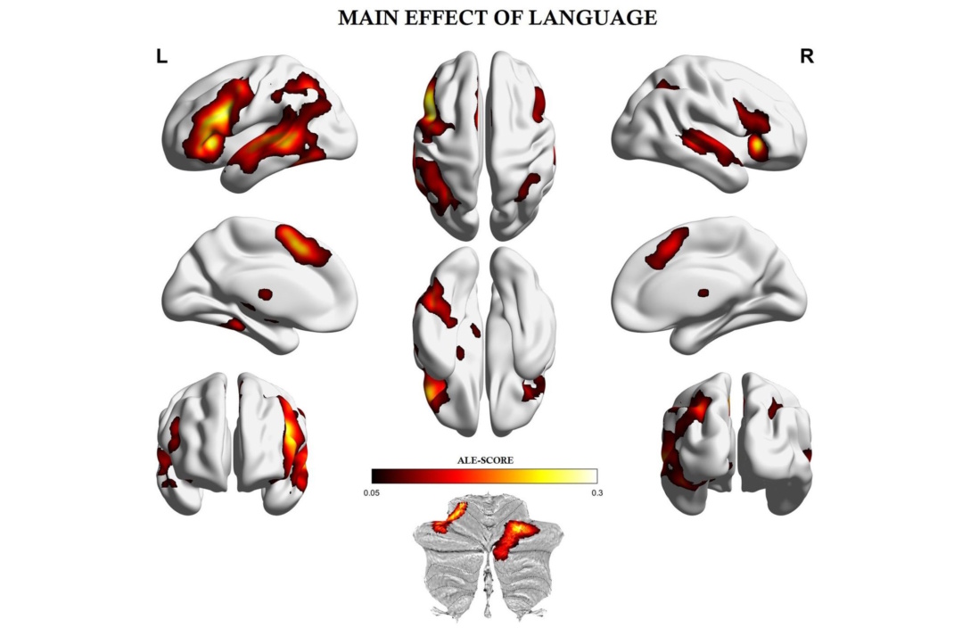 Sprachnetzwerk im menschlichen Hirn.