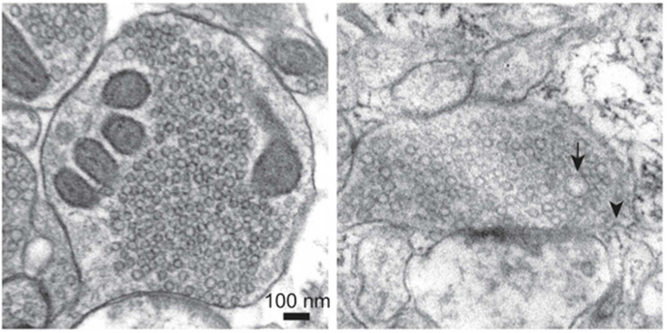 Links: eine ruhende, menschliche Synapse mit kleinen Vesikeln, die Neurotransmitter beinhalten. Rechts: eine Synapse, die 100 ms nach einem Aktionspotenzial schockgefroren wurde. Pfeilkopf: Membraneinstülpung, die neue Vesikel bildet: ultraschnelle Endozytose. Foto: Chelsy Eddings